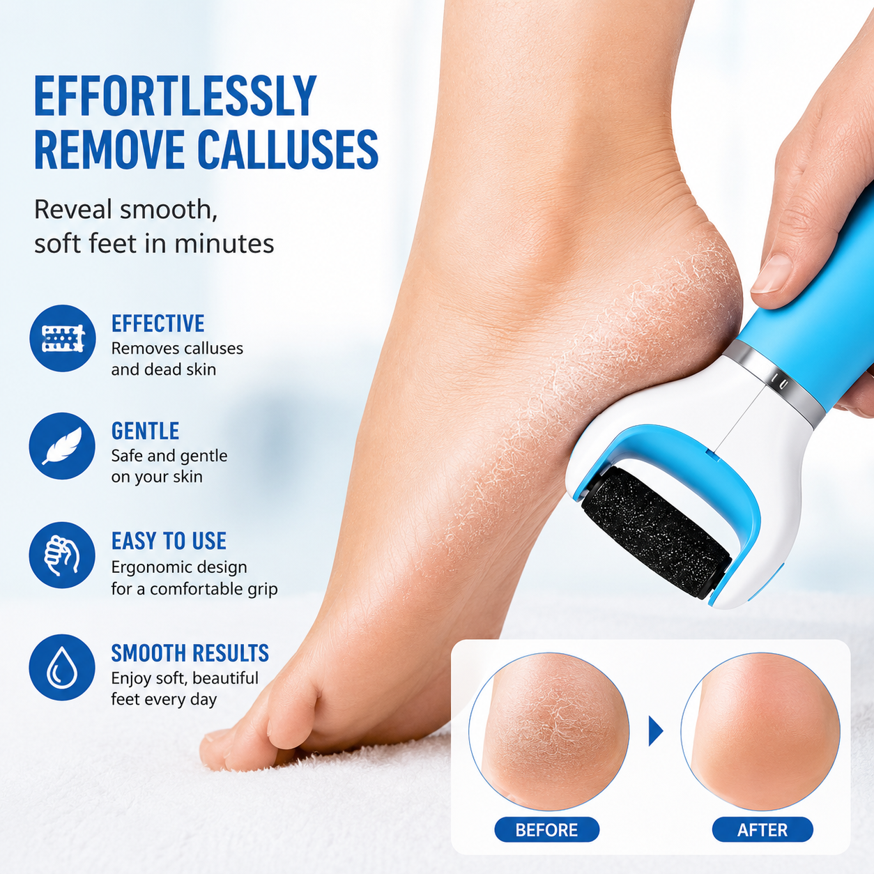 Electronic Foot Callus Remover