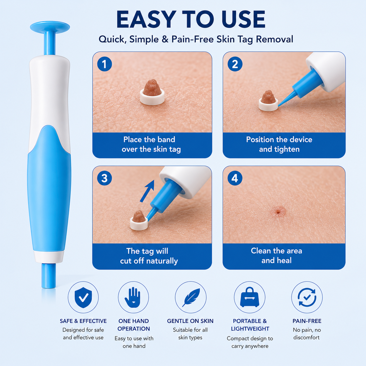Skin Tag Remover