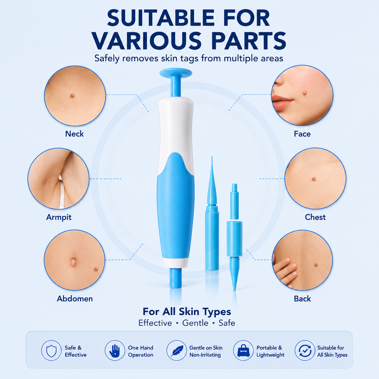 Skin Tag Remover